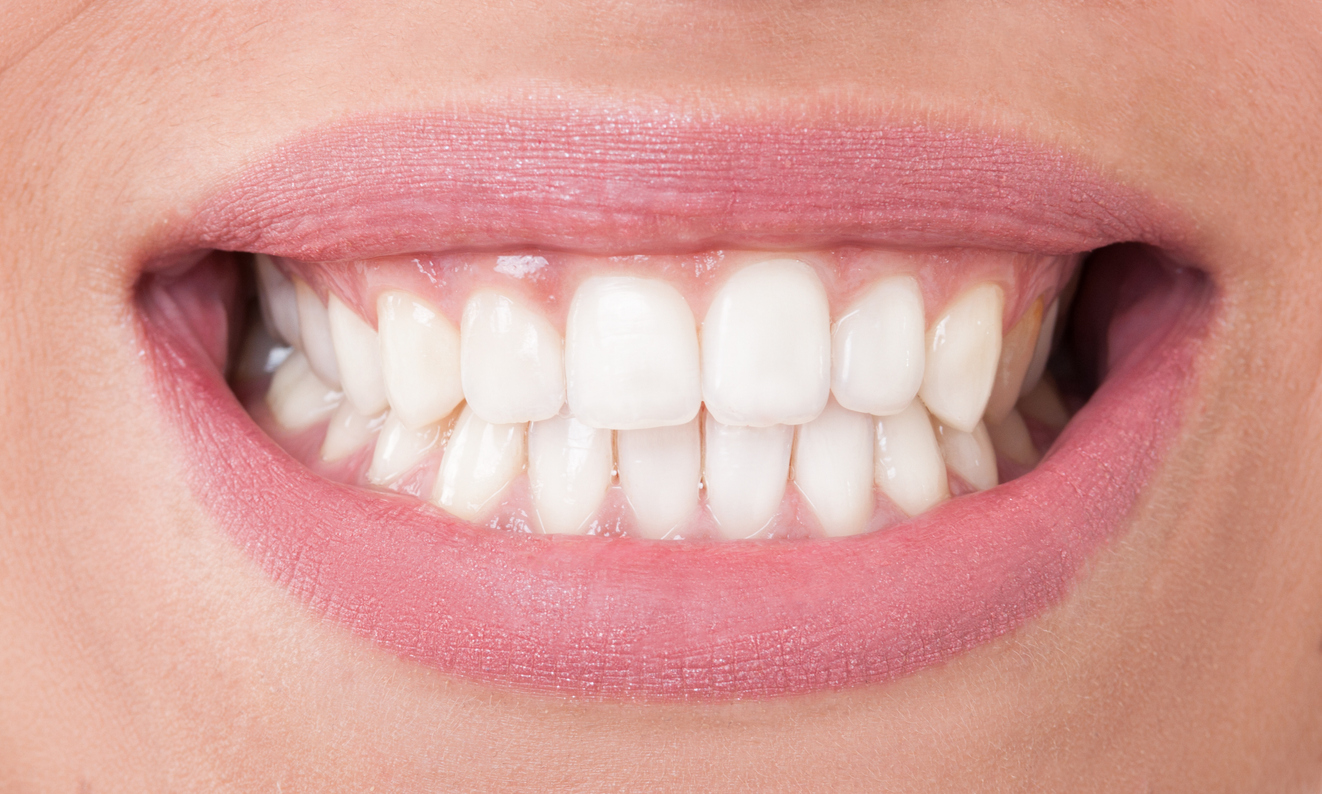 Gincement des dents : le bruxisme - Quel traitement possible?